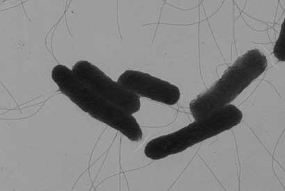 Shown is an image of Salmonella bacteria taken by an electron microscope. Researchers at UC Berkeley have turned this foodborne pathogen into an anti-viral delivery agent. (Sangwei Lu image)